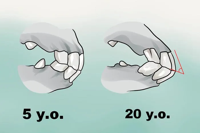Зубы лошадей в возрасте 5 и 20 лет